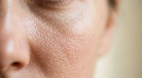 Gros plan sur la peau du visage montrant la texture et la barrière cutanée avec un éclairage doux et naturel